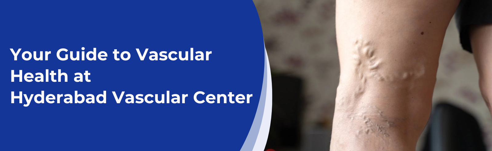 Your Guide to Vascular Health at Hyderabad Vascular Center